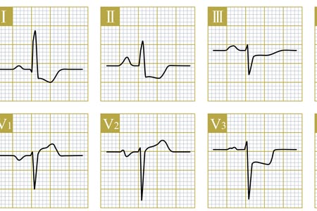 Basic 12 Lead ECG Interpretation Certificate Course (For Non-Nurse Healthcare Providers)