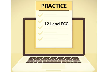 12 Lead ECG Practice Questions