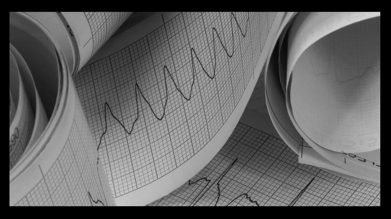 Cardiac Arrhythmia Interpretation