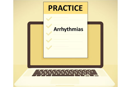 Arrhythmia Practice Questions