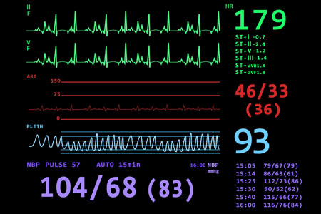Bedside Cardiac Monitoring