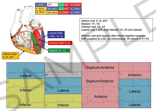 12 Lead ECG Reference Guide