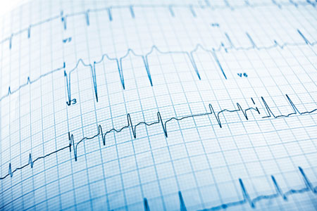 12 Lead ECG Interpretation: Skills for Advanced Practice