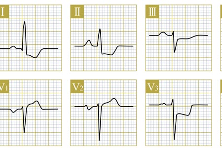 Basic 12 Lead ECG Interpretation Certificate Course (For Non-Nurse Healthcare Providers)