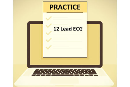 12 Lead ECG Practice Questions