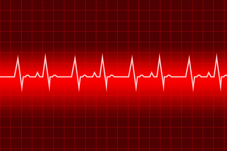 Cardiac Arrhythmia Interpretation for Nurses