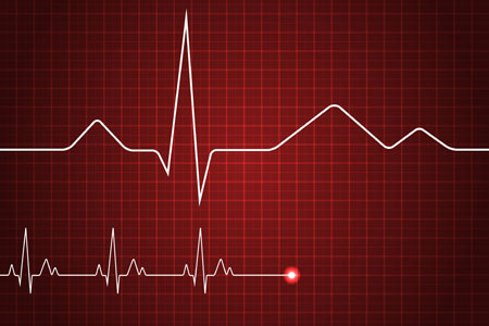 12 Lead ECG Mastery: From Novice to Expert