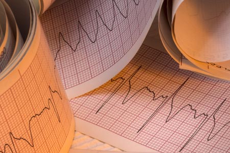 Basic Cardiac Arrhythmia Interpretation Certificate Course (For Non-Nurse Healthcare Providers)