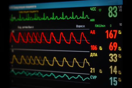 Hemodynamic Monitoring