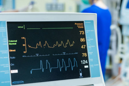 Shock States and Hemodynamics