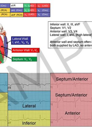 12 Lead ECG Reference Guide