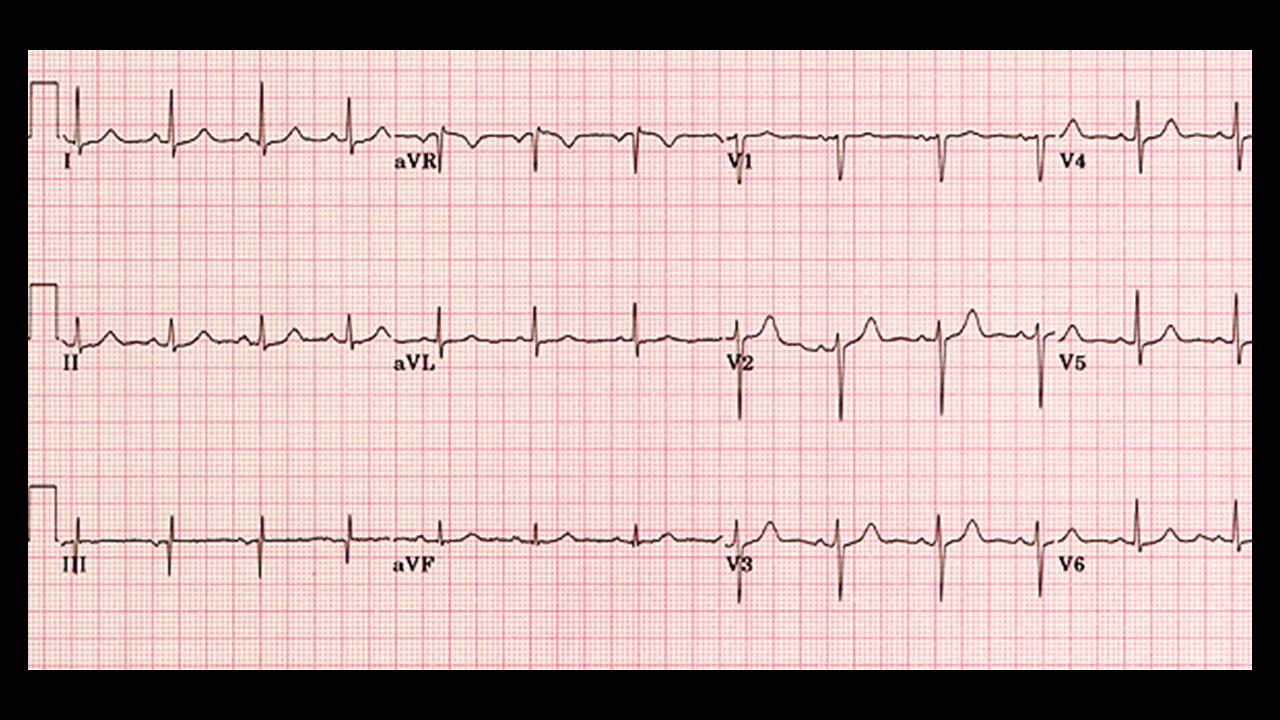 12 Lead ECG Courses