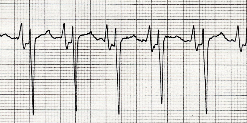 Cardiac Arrhythmias and Monitoring Short Course