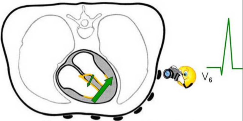 ECG Basics Short Course